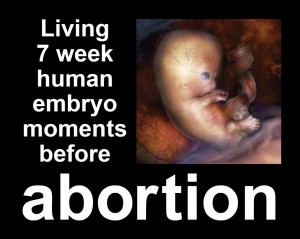Anti-Abortion Sign 1