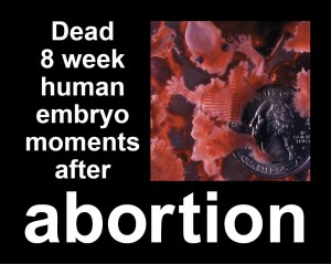 Anti-Abortion Sign 2